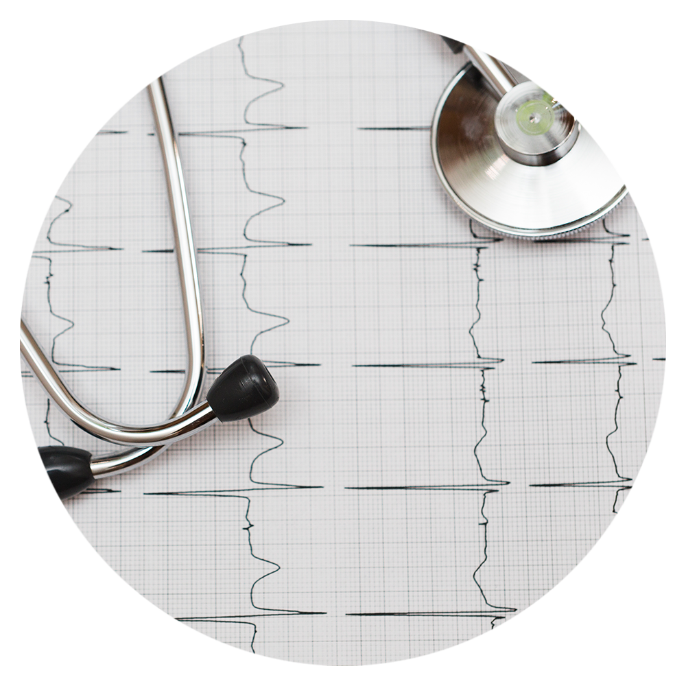 Stethoskop liegt auf einem EKG-Ausdruck mit Herzfrequenzkurven – Symbolbild für die Messung der Herzratenvariabilität als Methode zur Stressprävention und Gesundheitsvorsorge.